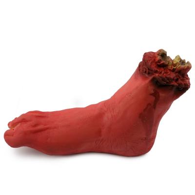  Нога оторванная 